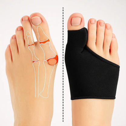 Bunion Corrector Sleeve with Gelpad for Hallux Valgus Relief
